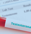 Distúrbios hormonais